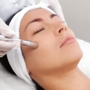 Microdermabrasion Facial