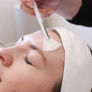 BioRePeel with Microdermabrasion